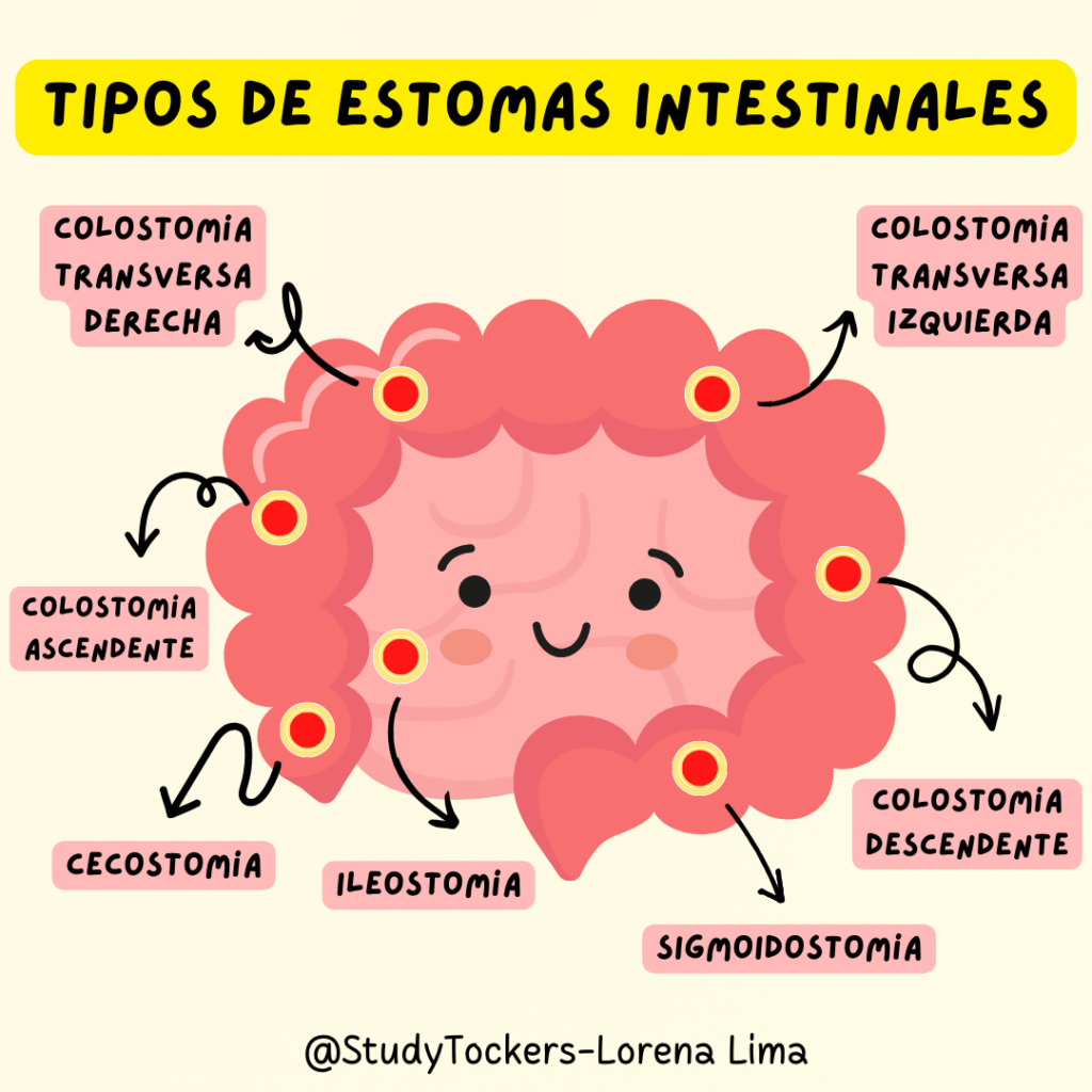 El Paciente Ostomizado Rinc n Del T cnico Sanitario
